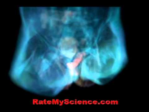 Sex under MRI - Anatomy of love, Rate My Science