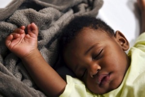 Two thumbs are seen on the right hand of sleeping one-year-old Kyrie Carter before surgery.