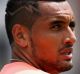 Nick Kyrgios of Australia