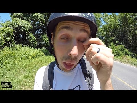 BUG IN THE EYE ON 20 MILE RIDE!