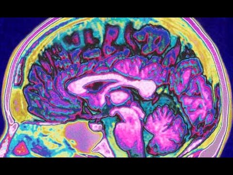 The Human Brain (full documentary) HD