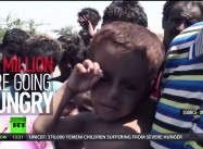 Starving Yemen