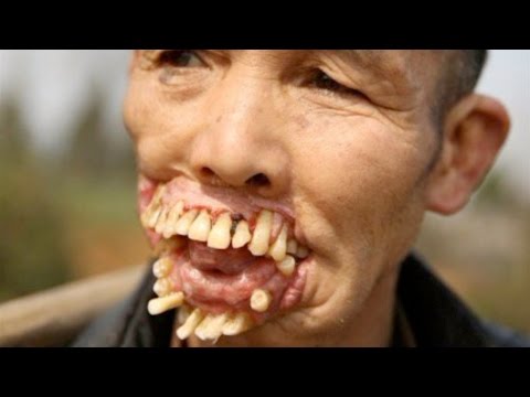 10 Scariest Diseases in the World