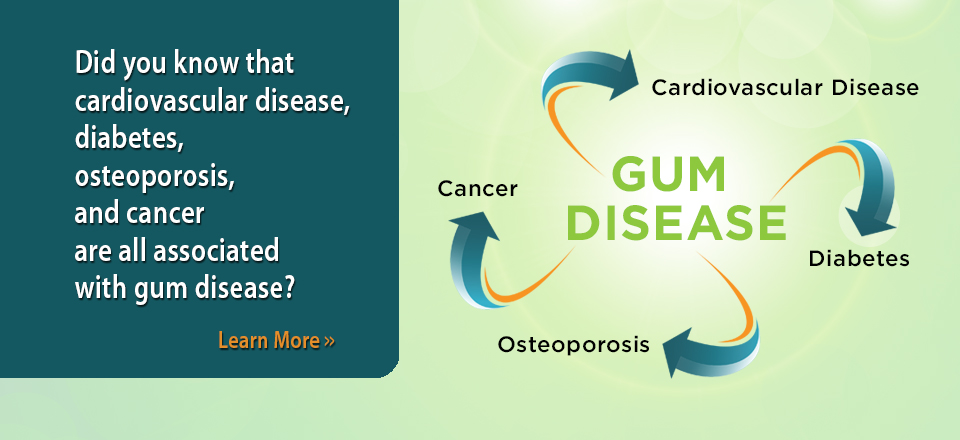 Gum Disease Systemic Link