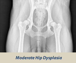 Moderate Dysplasia