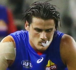 Bulldog Tom Boyd will take leave because of depression.