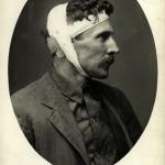 San Diego Free Speech Fight, California, 1912. Injured man, with head wound