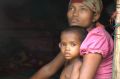 Four-year-old Rosmaida Bibi, who suffers from severe malnutrition, with her mother Hamida Begum's lap. She cannot grow ...