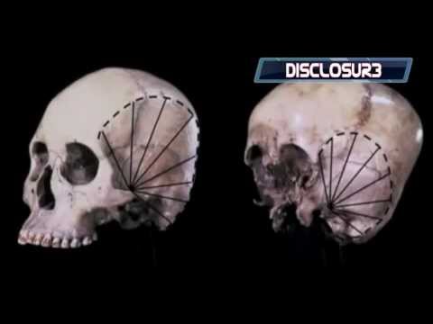 Starchild Skull- The SHOCKING DNA Results Are In....WATCH THIS! *HD*