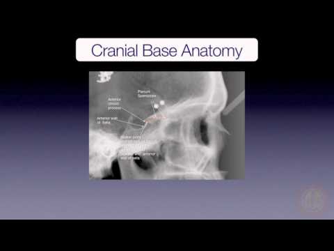 Cranial Base Superimposition