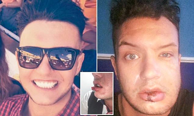 Model needs surgery to rebuild face after brutal attack