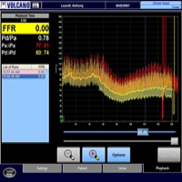 Hemodynamic Pressure Signals During FFR Figure 3a