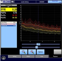 Hemodynamic Pressure Signals During FFR Figure 3b