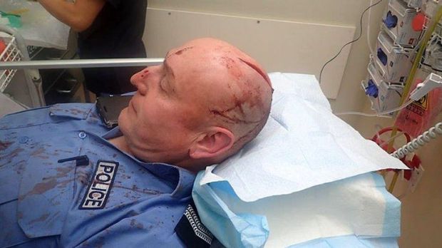 The officer was rushed to Royal Perth Hospital where he received a number of stitches to his wound.