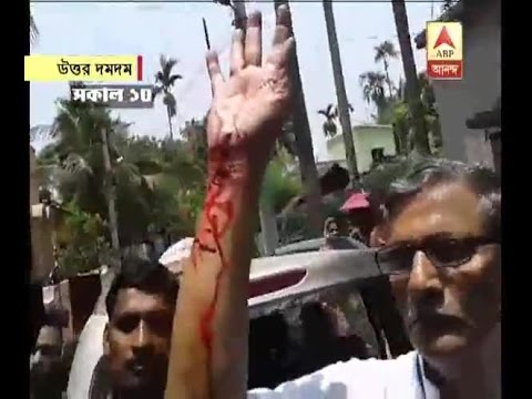 Bengal fifth phase poll: attack on CPM candidate of north Dumdum Tanmay Bhattacharya