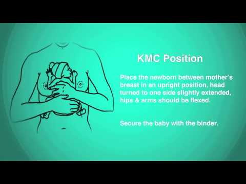 Kangaroo Mother Care (KMC)