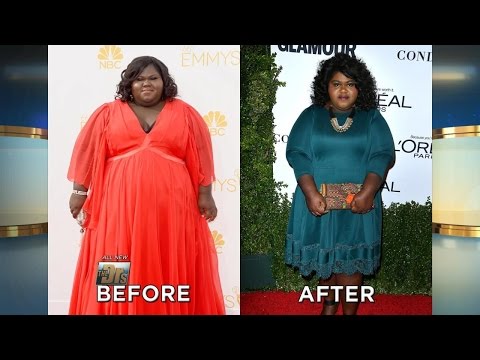 Gabourey Sidibe Reveals Weight Loss Surgery