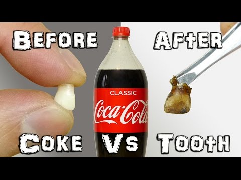 What Does It Do? - Coke Vs Teeth Experiment