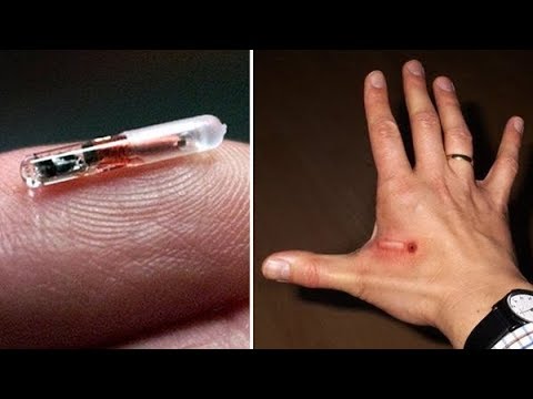 RFID Chip Being Implemented