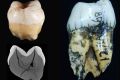 The incisor and molar discovered by Eugene Dubois in 1890.