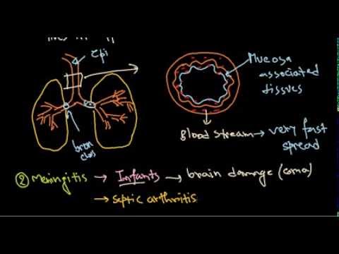 Haemophilus influenzae infection