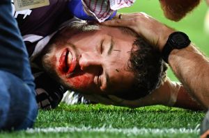 Horrible sight: Corey Oates is treated after the sickening head knock.