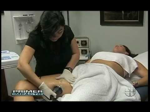 Ultra Cavitation: Lipo Without Surgery