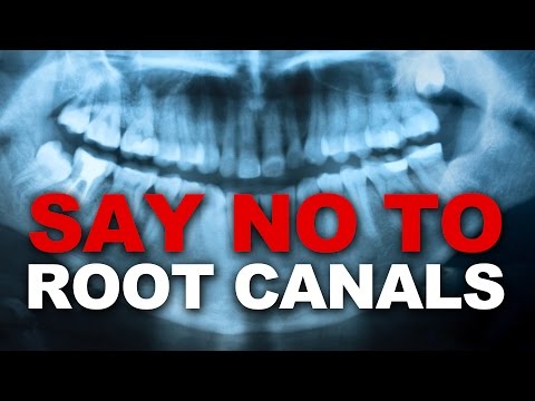 Say NO to Root Canals - Damaging to your Health