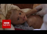 A Yemeni Child Dies Every 10 Minutes as Saudi Attacks Continue