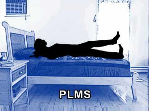 Understanding Restless Legs Syndrome (Health Guru)