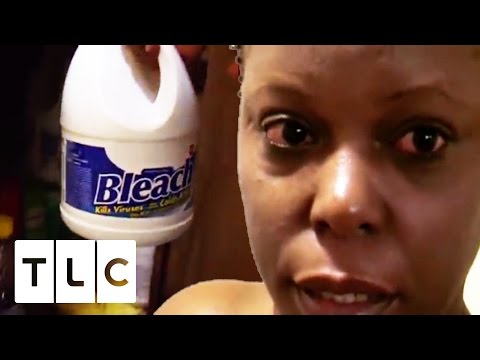 Addicted to Bathing In Bleach | My Strange Addiction