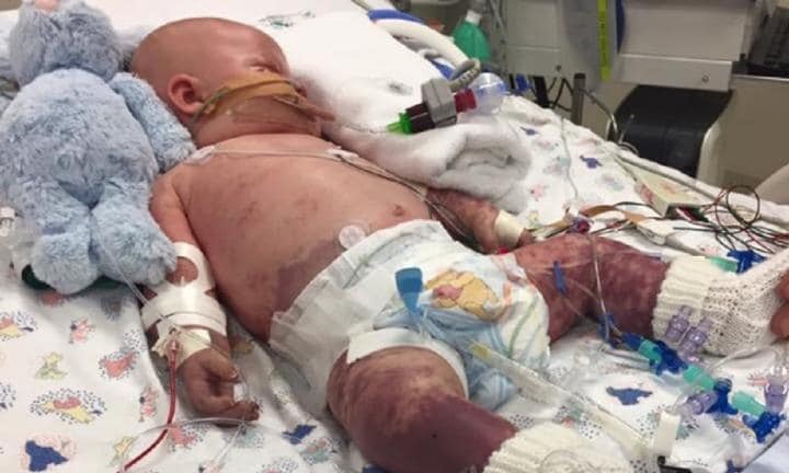 Parents' meningococcal horror. Baby Archie diagnosed at just five months