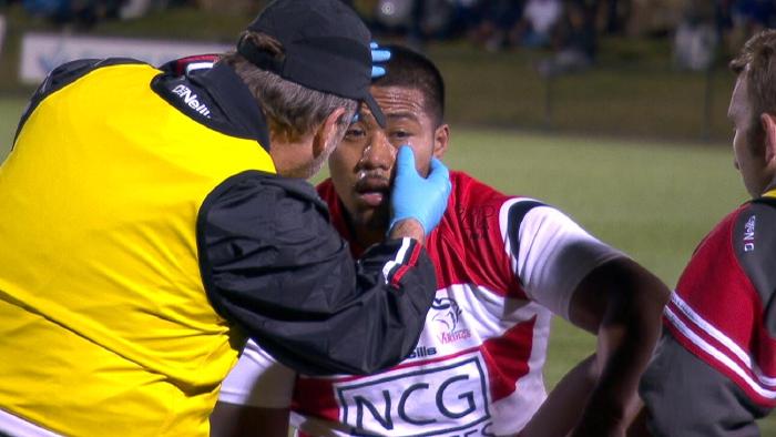 Folau Fainga’a receives treatment to his eye.