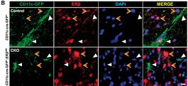 Novel Complementary Effects of Estrogen Treatment in Multiple Sclerosis