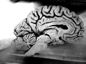 Human brain section