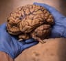 Australia's first sports brain bank launched to find head injury and disease link