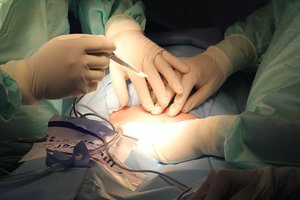 Doctors in operating theater in a hospital where surgical operations are carried out.