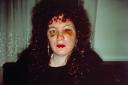 Nan Goldin, ‘Nan one month after being battered’ 1984