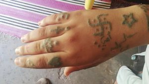 This undated photo provided by febrayer.com website shows tattoo marks on a 17-year-old Moroccan girl who told police she was gang-raped, forcibly tattooed and held against her will for two months, near Beni Melal, central Morocco.