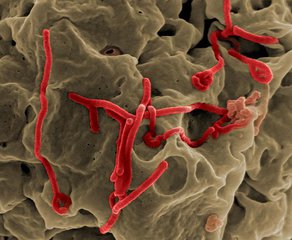 Ebola Virus (3)