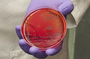 FDA's Center for Food Safety and Applied Nutrition research  bacterial and chemical contaminants out of the food supply, and to rapidly identify the disease-causing Salmonella bacteria