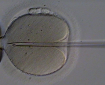 A human oocyte is held by a glass holding pipette (left). A beveled glass pipette containing an immobilized ejaculated spermatozoon is inserted through the zona pellucida and deep into the oolemma, creating a deep furrow. Once the membrane of the oocyte is penetrated, the sperm is deposited therein.