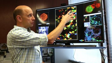 Matthew Krummel at his lab worked in the 1990s at a lab at the University of California, Berkeley, that would become one of the most influential in the development of immunotherapy. 