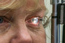 Close up of a woman getting the Alzheimer eye test.