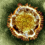 New, mysterious and deadly: What is the coronavirus and should you be worried?