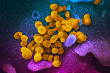 Novel coronavirus (yellow) emerges from the surface of cells in a culture grown from a patient in the United States.  