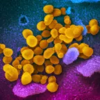 Novel coronavirus (yellow) emerges from the surface of cells in a culture grown from a patient in the United States.  