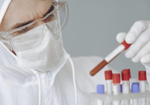 Photo of person wearing face mask and protective gear with a Coronavirus Covid-19 test sample for vaccine study