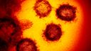 The Novel Coronavirus SARS-CoV-2 - also known as 2019-nCoV - is shown under a microscope. The virus causes COVID-19. 