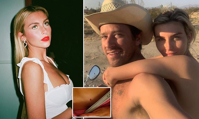 This is the 'A' Armie Hammer branded his ex-girlfriend Paige Lorenze with using a cutting